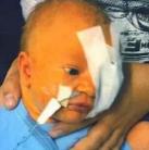 Kegyetlen! Szülés közben véletlen kitépték a baba egyik szemét (fotóval)